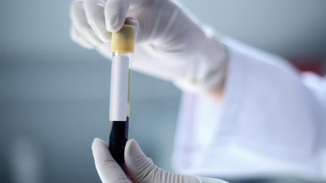 Bloodborne Pathogens in First Response Environments - Safety online training course
